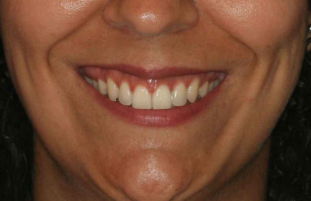Después de ser atendido por la Doctora Maite, en nuestra Clínica Dental experta en tratamientos de ortodoncia